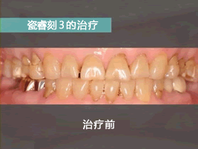 施術前