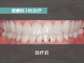 施術後