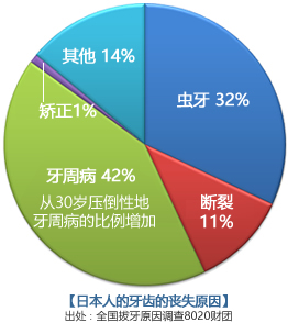 予防歯科とは
