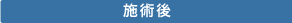 保険外診療の施術例1(施術後)
