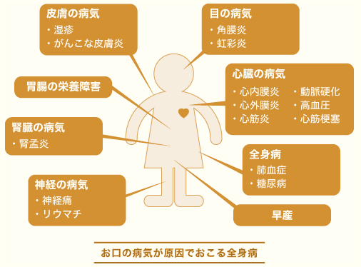 お口の病気が原因でおこる全身病