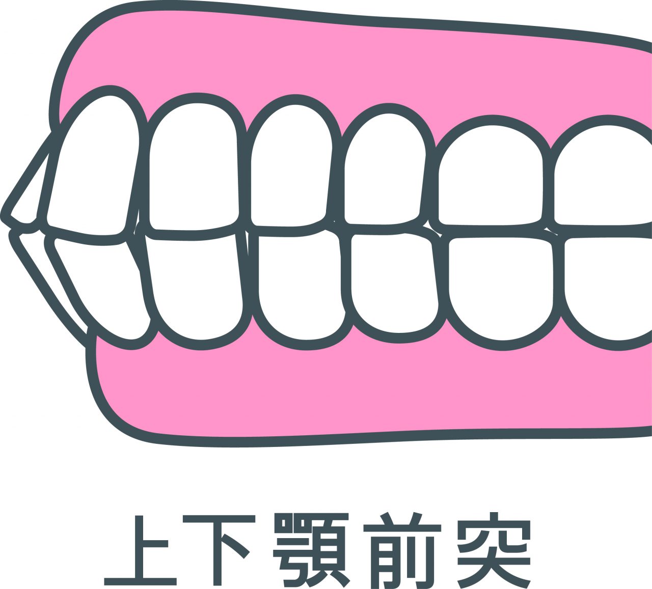 指しゃぶり、やめなくて困っています - 東大阪の歯医者です。