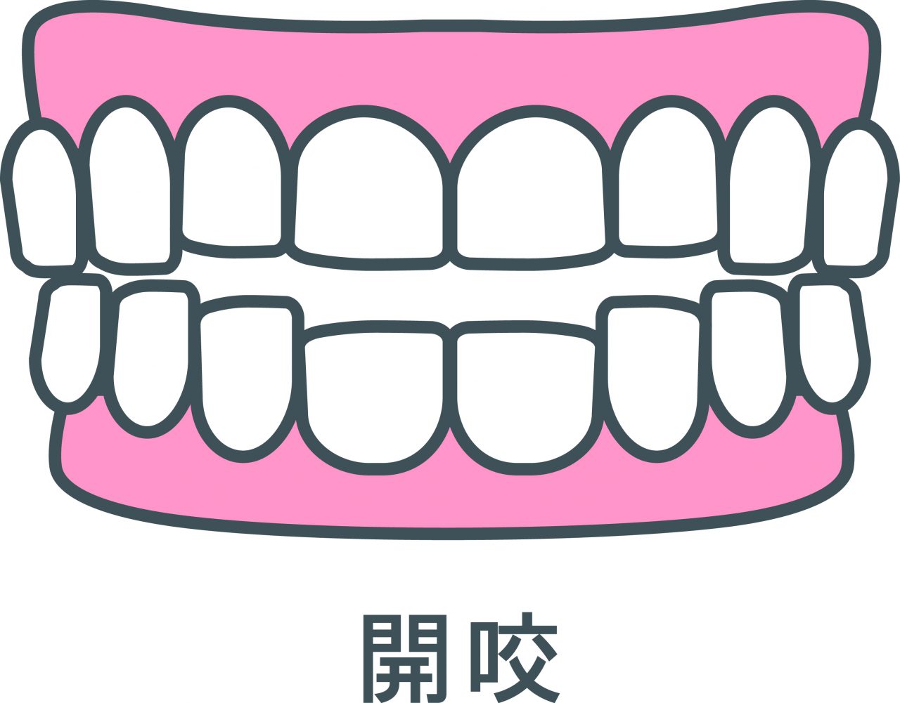 指しゃぶり、やめなくて困っています - 東大阪の歯医者です。