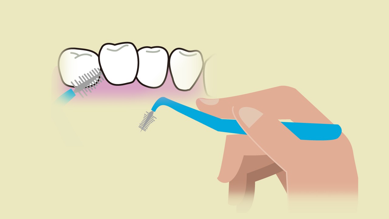 歯間ブラシ