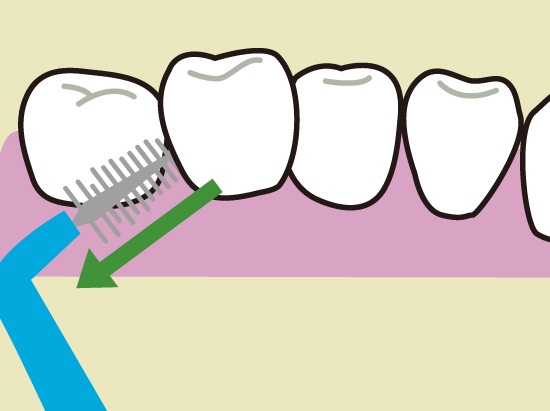 歯間ブラシの使い方3