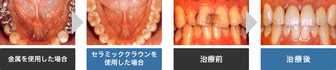 ã»ã©ããã¯ã¯ã©ã¦ã³