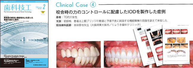 歯科技工士向けの専門誌「歯科技工」に掲載されました。