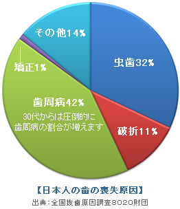 予防歯科とは