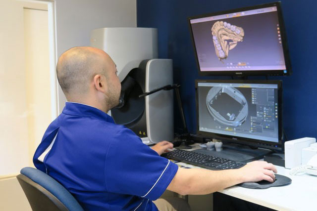 コンピュータの3D画面上で修復物を設計