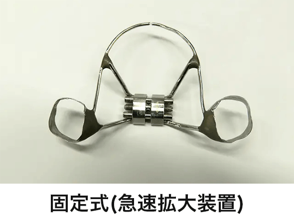緩徐拡大装置固定急速